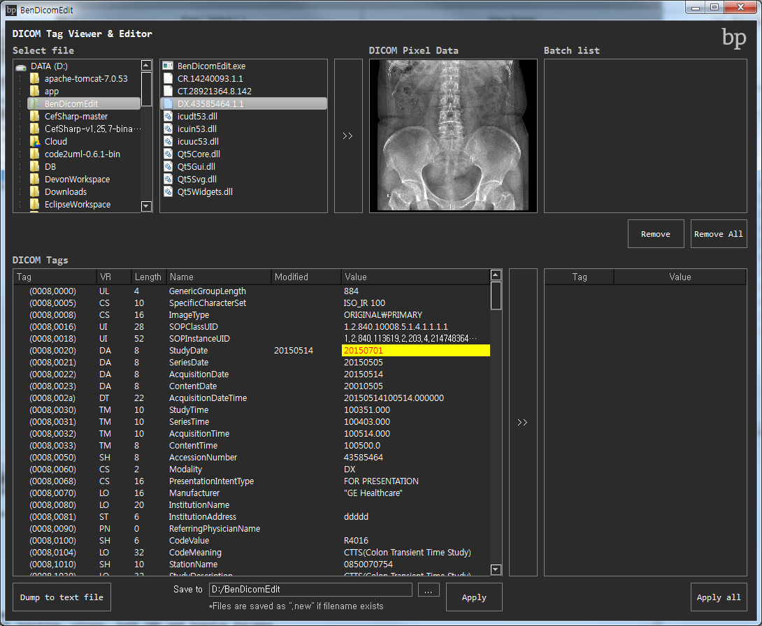download the last version for iphoneLim DICOM Viewer